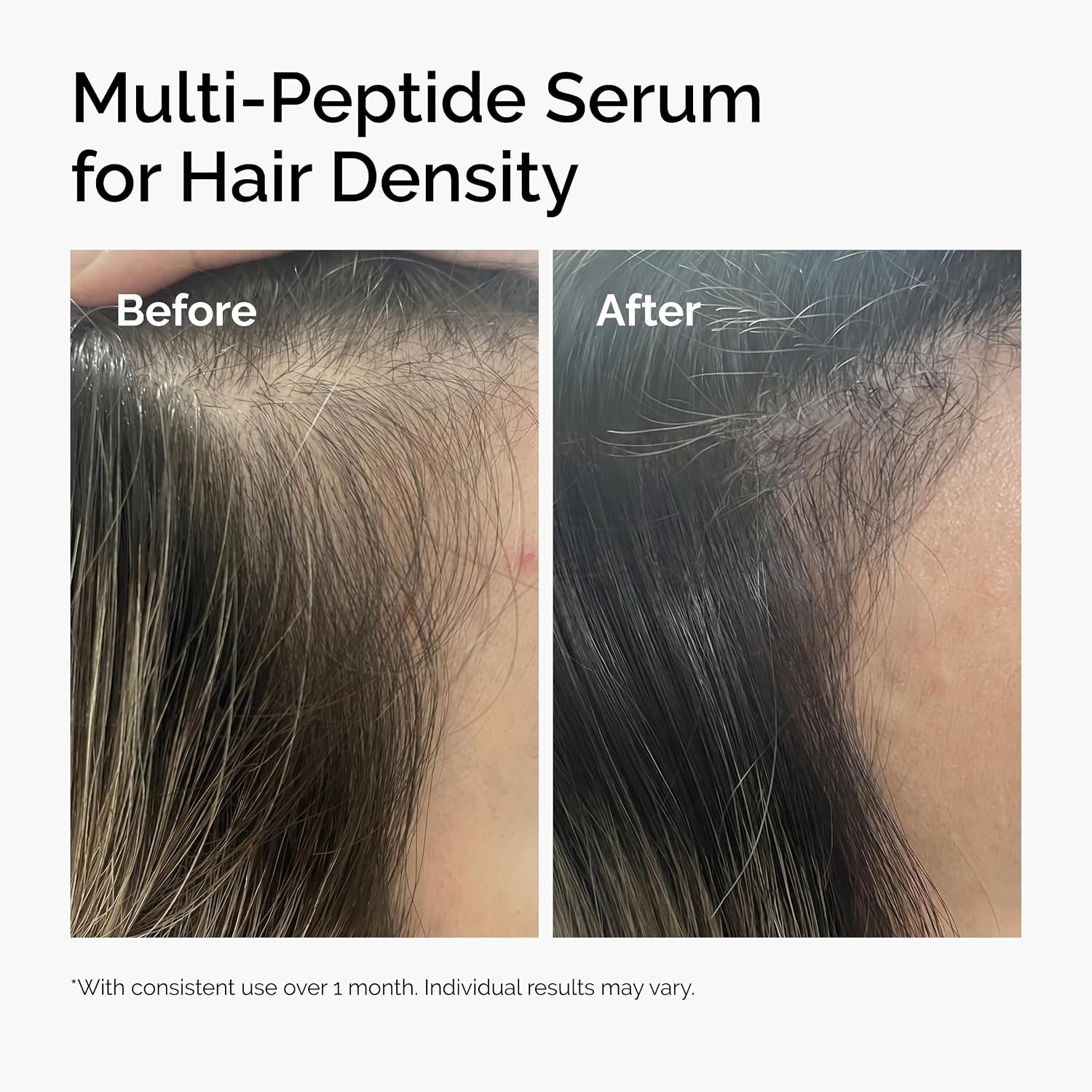 The Ordinary Multi-Peptide Serum for Hair Density, Peptide-Powered Formula for Thicker, Fuller Looking Hair